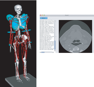 Biomechanics